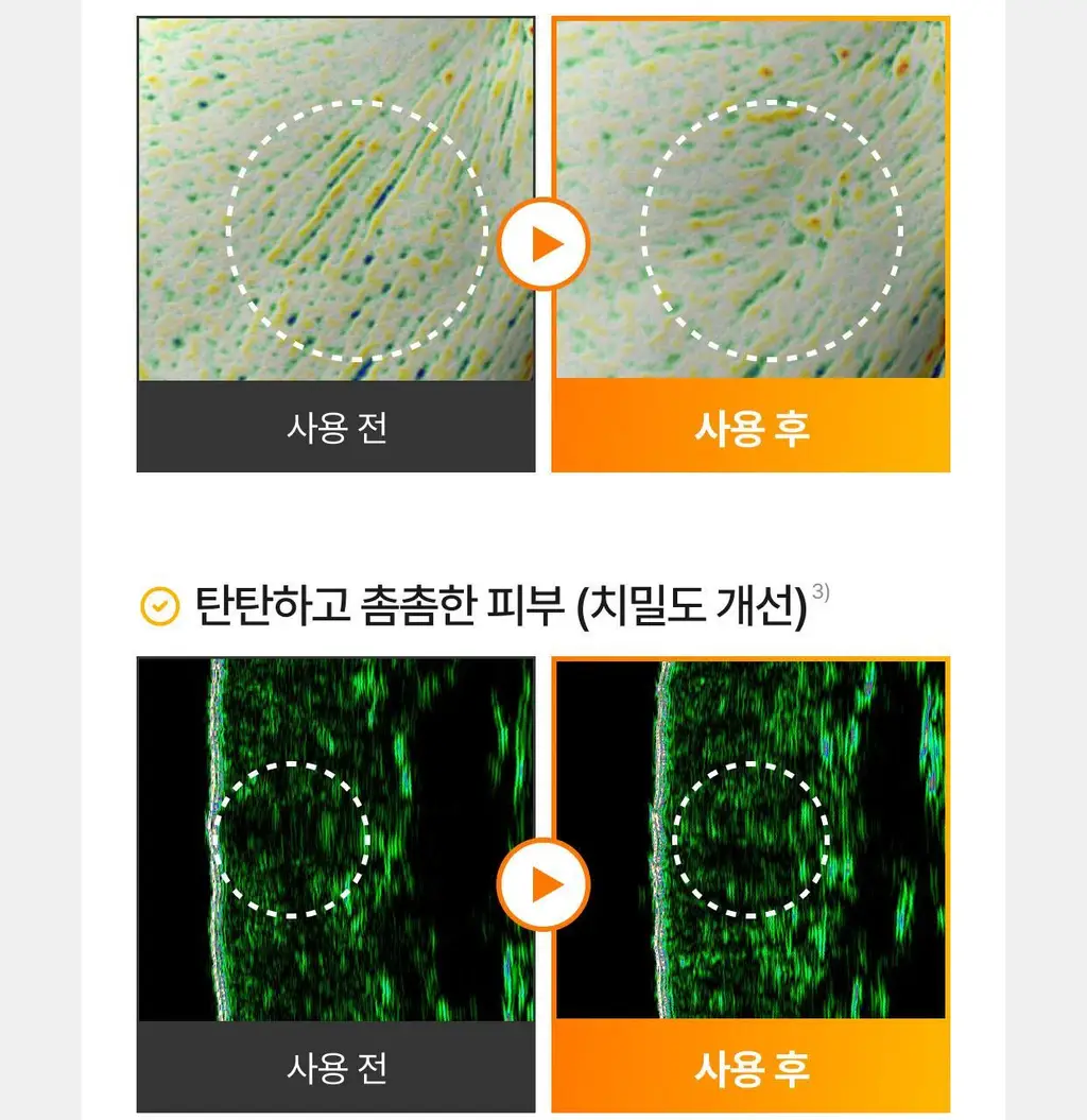 [잡티토닝/TXA] 셀리맥스 브라이트닝 모공잡티 크림 35ml 상세페이지 22